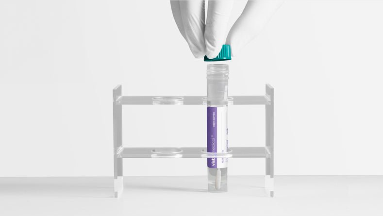 Visby Medical Respiratory Health External Positive and Negative Controls - Verséa Diagnostics